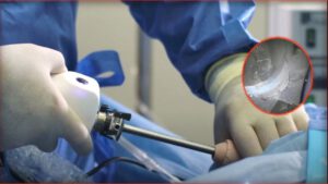 סרטים לבתי חולים